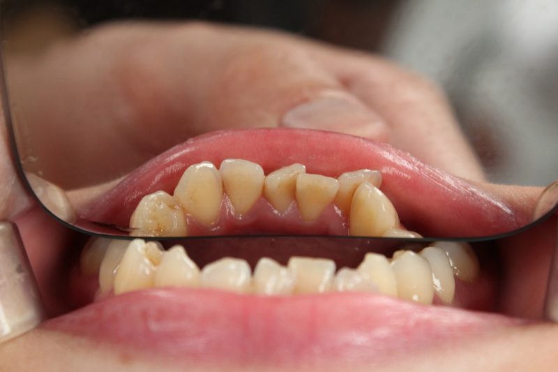 4 Ways a Dentist Can Help Your Smile